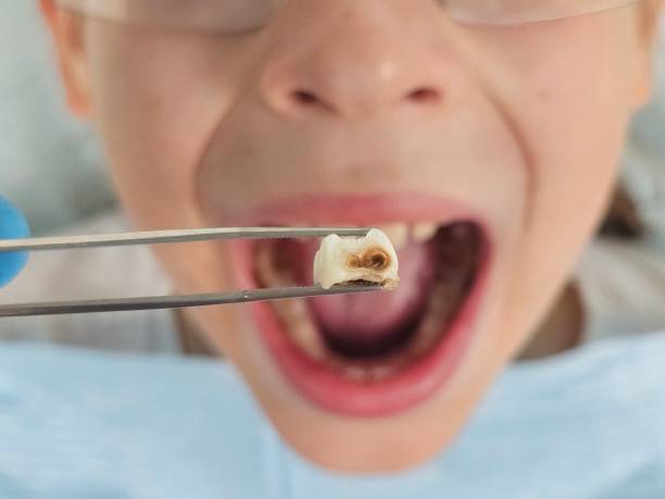 Best Pediatric Emergency Dentist in South Toms River, NJ