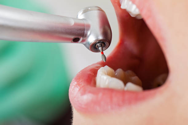 Best Emergency Treatment for Toothache in South Toms River, NJ